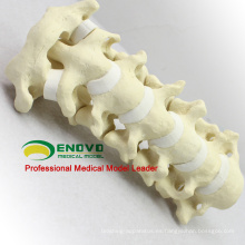 SONDAS DE SIMULACIÓN AL POR MAYOR 12312 Anatomía Médica Columna Cervical Artificial, Ortopedia Práctica Simulación ósea